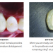 Clinical Research Dental Gallery Image